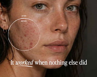 Mineral Skincare