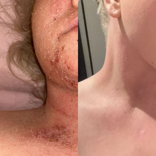 Before and After Sea Magik Dead Sea Salt Dry Skin Repair Kit