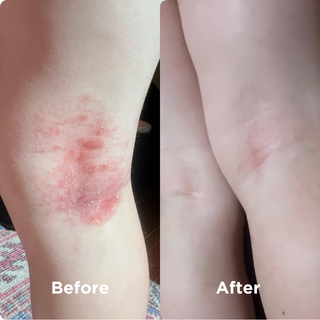 Before & After Natural Skin Softener