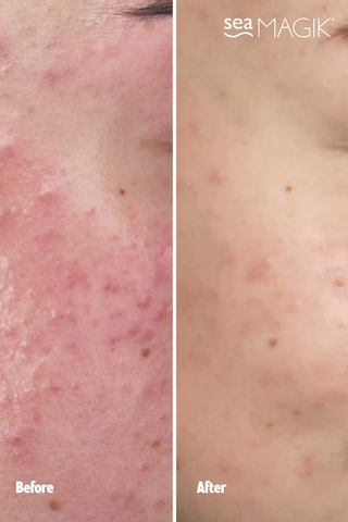 3-Step Face Skin Health