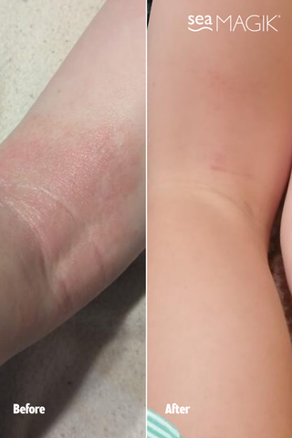 2-Step Body Skin Health